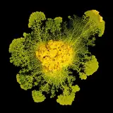 Une photographie au microscope du blob, organisme unicellulaire jaune.